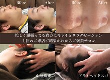 頭のオアシすぱ