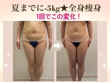 サイエス 八代(SAIs)の雰囲気(一回施術で-3cm☆実現!肋骨が締まってバストアップ効果も!)