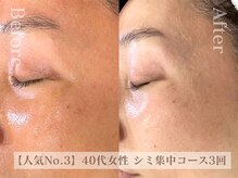 ディレイア ザ コスメ 有楽町マルイ店(direia the cosme)/紫外線ダメージ/日焼［有楽町］