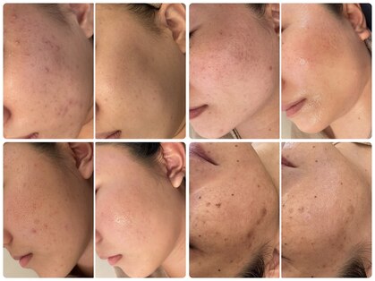 ニコリ(Nicori)の写真