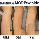 モアトゥインクル 岡山店(MORE twinkle)