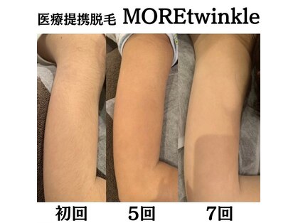 モアトゥインクル 岡山店(MORE twinkle)の写真