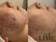 ライム 北千住(LIME)の写真