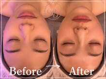 R-1ビューティーサロン 表参道/Before＆After