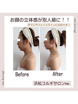 ミードット(me.)/フェイスラインくっきりで立体顔