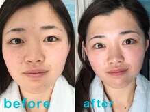 エステティックアンドリラクゼーション マリティーム(MARITIME)の雰囲気(フランス式ハンドマッサージ&リフトアップバンテージ)