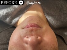 アングレイス(Anngrace)/ 【人気No.3】小顔フェイシャル