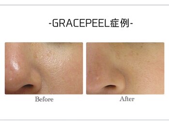 韓国肌管理・白玉肌管理 HOPE Retailer 安城店【3月OPEN(予定)】/施術写真