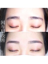 アイラッシュサロン ヴェリィ(VERRY.)/困り眉改善