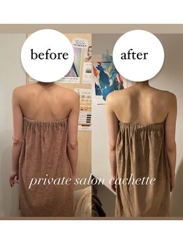 カシェット(cachette)/ブライダルエステ