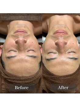 エレーナ(ELENA)/メンズフェイシャルベーシック