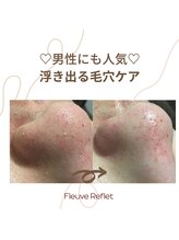 フルーヴ ルフレ(Fleuve Reflet)/メンズにも人気♪毛穴ケア！！