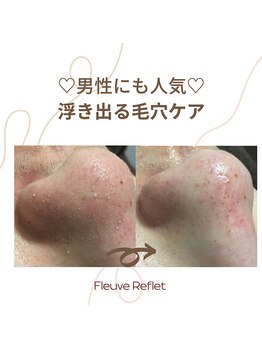フルーヴ ルフレ(Fleuve Reflet)/メンズにも人気♪毛穴ケア！！