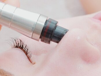 ビューティールーム リヴィア(BEAUTY ROOM RIVIA)の写真/【毛穴洗浄&美白¥5500】人気のハイドロフェイシャルで鼻の毛穴洗浄!角栓を取り除き,黒ずみ毛穴レス潤い肌へ