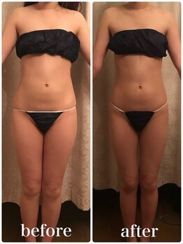 パルフェット(parfaite)/ハイパーナイフで温活&痩身