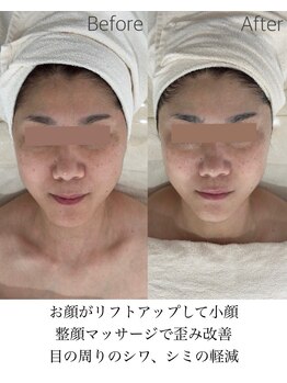 コアラッシュ 福井フェニックス通り店(COA LASH)/リアボーテといえばハーブ