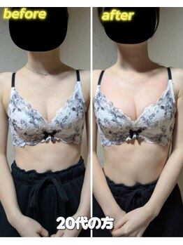 スノードロップ(snowdrop)/バストケア[１回でのバストUP]