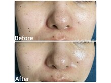 ちらちゅら/クリスティーナ【アンストレス】