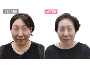 ジタ整体院/小顔コース☆50代女性