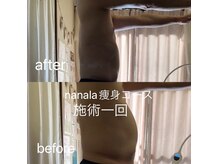 ナナラ(nanala)の雰囲気（メンズの痩身コースも人気メニューです！）