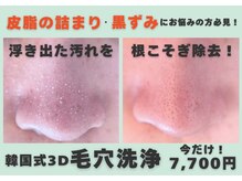 ドクターアリィ(Dr.ALII)の雰囲気（【韓国式3Ｄ毛穴洗浄】気になる毛穴を一発除去★羽島/岐南）