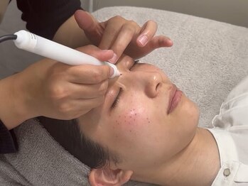 コリー(Kolly)の写真/痛みが心配な方も不安なく通っていただける丁寧＆優しい施術を心掛けています◎お悩みのシミへアプローチ♪