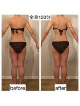 ココラーレ(cocorare)/痩身/日暮里/荒川区エステサロン