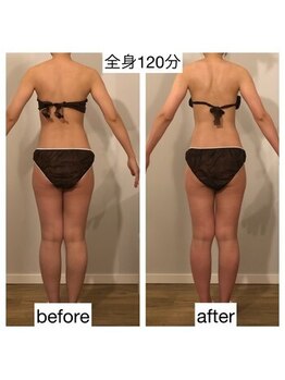 ココラーレ(cocorare)/痩身/日暮里/荒川区エステサロン