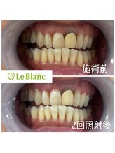 ルブラン 奈良店(Le Blanc)/まずはお試しクーポンで♪