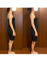 テマモリ(temamori)/施術ビフォーアフター(2回)