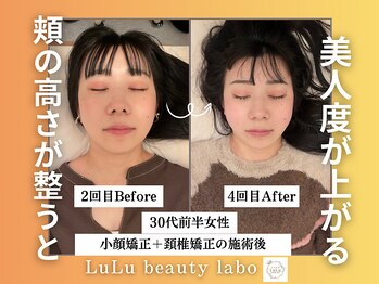 ルルラボ(LuLu beauty labo)/頬の高さで変わる、美人バランス