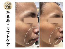 グラツィア(Grazia)/口元に年齢を感じたら早めのケア