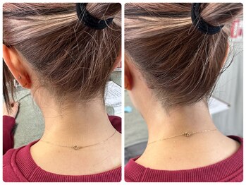 ムーンサン(Moon sun)/うなじ　ワックス脱毛