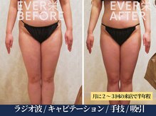 エヴァーグレース 宇都宮店/ 燃焼系BODY作りサポートします