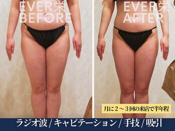 エヴァーグレース 宇都宮店/ 燃焼系BODY作りサポートします
