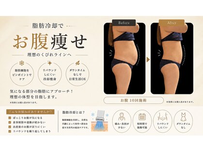 エムズビューティーサロン(M's Beauty Salon)の写真