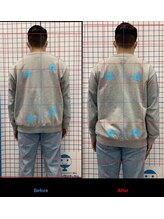 マーサ鍼灸接骨院 イオンタウン浜松葵院/お客様施術例【浜松葵/静岡】