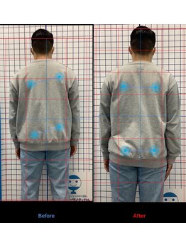 マーサ鍼灸接骨院 イオンタウン浜松葵院/お客様施術例【浜松葵/静岡】