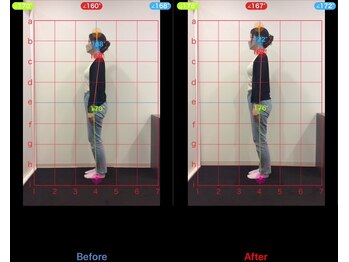 ケアルーム 茅ヶ崎(CAREroom)/施術効果写真☆(before after)