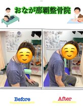 おなが浦添当山整体院/クビ・肩の痛み、可動域改善！