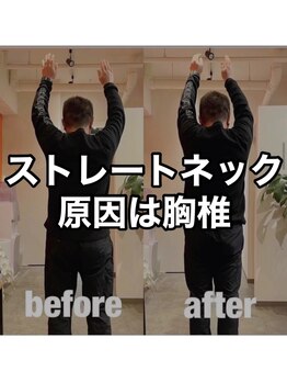 カワル整体 上通り院/首を触っても、首は改善しません