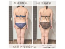 レディジュ 盛岡店(Ladyge)の雰囲気（筋膜をほぐし本来のご自身が持つキレイなボディラインへ◎）