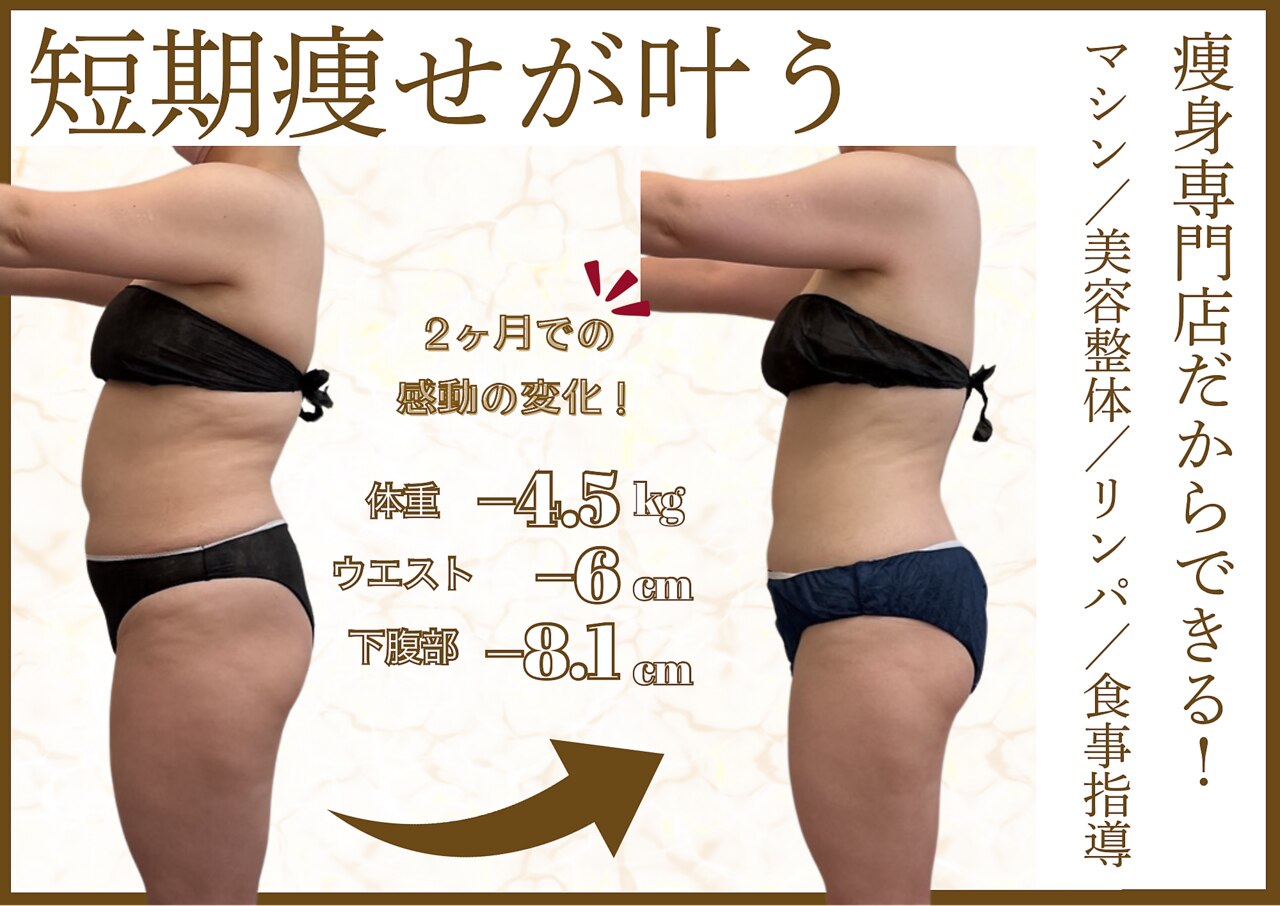 ビーカムチュー　サロン専売品。ダイエット・痩身 ビーカムチュー サロン専売品。ダイエット・痩身