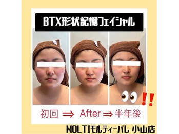 モルティーパレ(Molti Palais)/