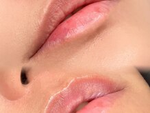 ハーモニー(harmony)/ローマピンク　ビフォーアフター