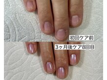 ネイルサロンアンドスクール マルベリー(mulberry)の雰囲気（爪が伸びなくて縦筋が気になっていたけど縦長になり満足です！）