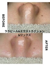 ジーンバイピエル 中野店(gene by PIEL)/#毛穴ケア#ピーリング#ワックス