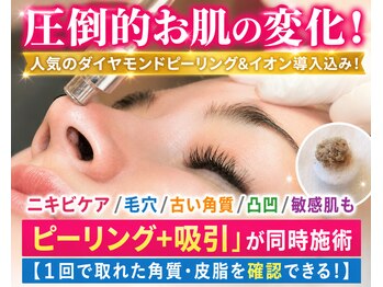 サロンドエステケイワイ(de KY)の写真/圧倒的お肌の変化！人気のダイヤモンドピーリング&イオン導入！ニキビケア/毛穴/古い角質/凸凹/敏感肌も◎