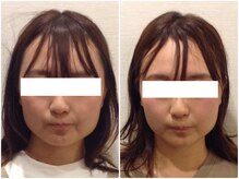 美容整体ウェリナ あま甚目寺院/小顔矯正/骨盤矯正/美脚サロン