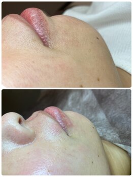 スパッツィオ(spazio)/【フェイシャルワックス】男女可